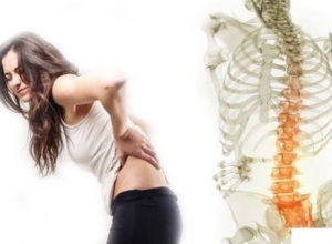 Tiêu chuẩn chẩn đoán thoái hóa cột sống thắt lưng